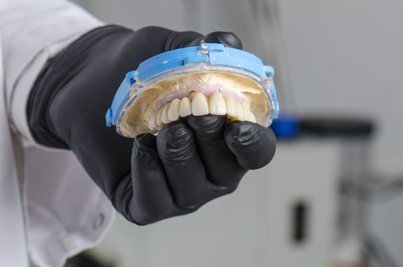 a full arch dental implant in the hand of a dental implant dentist.