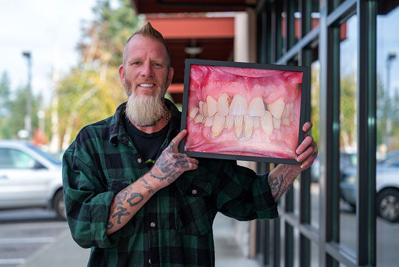 Patient holding up before and after image