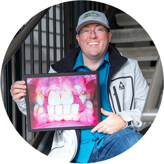 Patient Holding up before and after image